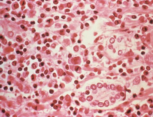Why Liver Disease Is Called the Silent Health Problem